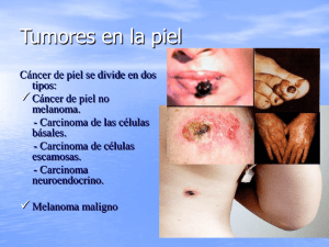 Tumores en la piel