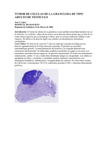 tumor de celulas de la granulosa de tipo adulto de testiculo
