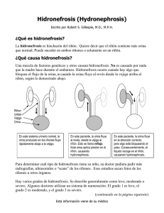 Hidronefrosis - KidneyWeb.net