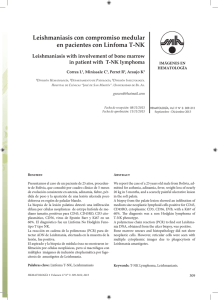 Leishmaniasis con compromiso medular en pacientes con Linfoma T-NK