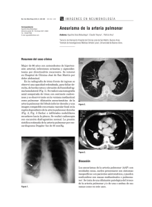 Aneurisma de la arteria pulmonar 233