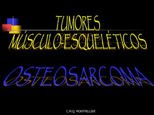 Tumores músculo esqueléticos: Osteosarcoma
