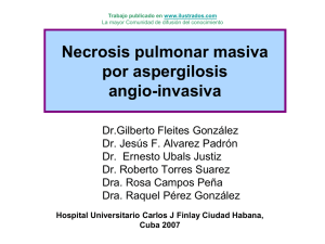 http://www.ilustrados.com/documentos/necrosis-pulmonar-aspergilosis-angio-invasiva-140708.ppt