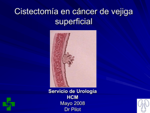 Cistectomia_en_cancer de_vejiga superficial.ppt