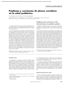 Papiloma y carcinoma de plexos coroideos en la edad pediátrica