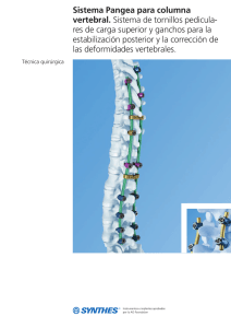 Sistema Pangea para columna vertebral Técnica quirúrgica