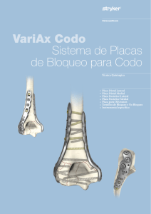 VariAx Codo Sistema de Placas de Bloqueo para Codo