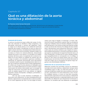 Capítulo 57 Qué es una dilatación de la aorta torácica y abdominal