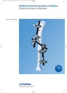 Fijadores externos grande y mediano. Sistemas de barras modulares.