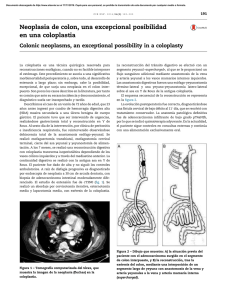 Neoplasia de colon, una excepcional posibilidad en una coloplastia