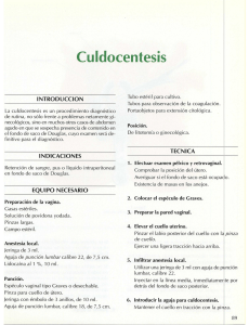 Culdocentesis