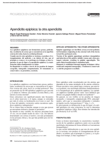 Apendicitis epiploica: la otra apendicitis