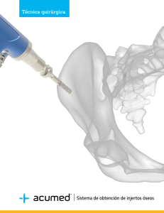 Técnica quirúrgica Sistema de obtención de injertos óseos