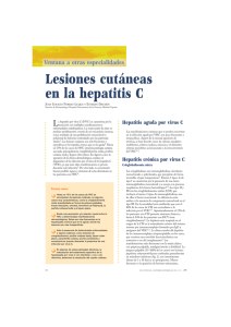 Lesiones cutáneas en la hepatitis C