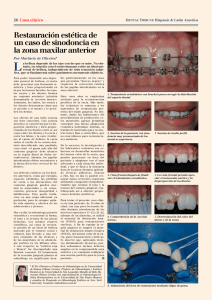 Restauración estética de un caso de sinodoncia en la zona maxilar