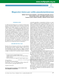 Megacolon tóxico por colitis pseudomembranosa