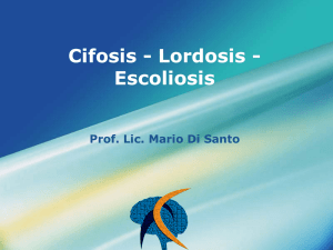 Cifosis - Lordosis - Escoliosis