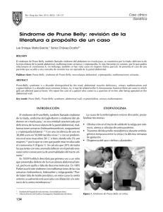 Síndrome de Prune Belly: revisión de la literatura a