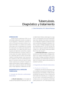 Tuberculosis. Diagnóstico y tratamiento