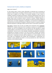 Formas de dar Función y Estética en Implantes