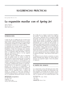 La expansión maxilar con el Spring Jet