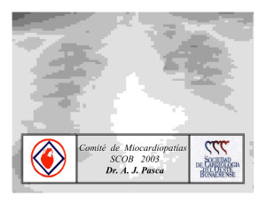Miocardiopatía Dilatada Ecocardiografía
