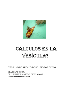 folleto de calculos de vesicula