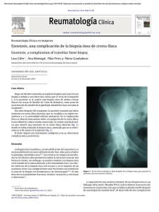 Exostosis, una complicación de la biopsia ósea de cresta ilíaca