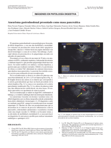 Aneurisma gastroduodenal presentado como masa pancreática