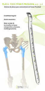 placa torx femur proximal