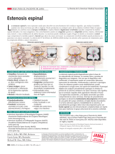 Estenosis espinal