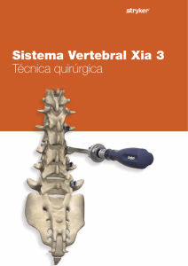 Sistema Vertebral Xia 3 Técnica quirúrgica