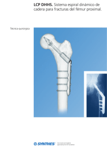 LCP DHHS. Sistema espiral dinámico de cadera para fracturas del