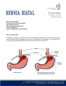 ¿Qué es la hernia hiatal? - coloproctologia