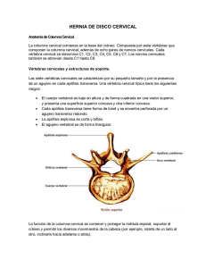 hernia de disco cervical - Neurocirugia Endovascular