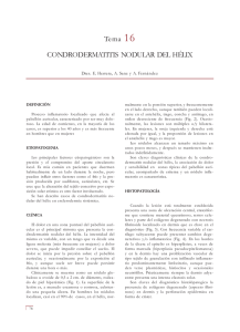 Tema 16 CONDRODERMATITIS NODULAR DEL HÉLIX