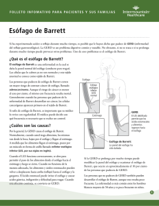 Esófago de Barrett - Intermountain Healthcare