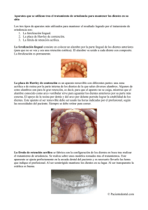 Aparatos que se utilizan tras el tratamiento de ortodoncia para