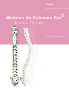 Sistema de Columna Xia® Técnica Quirúrjica