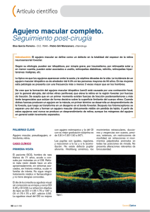 Agujero macular completo. Seguimiento post