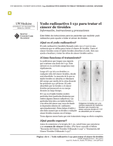 Yodo radioactivo I-131 para tratar el cáncer de tiroides