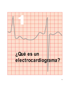 ¿Qué es un electrocardiograma?