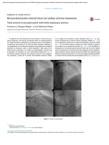 Revascularización arterial total con ambas arterias mamarias