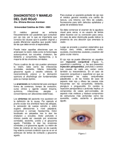 diagnostico y manejo del ojo rojo