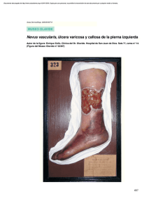 Nevus vascularis, úlcera varicosa y callosa de la pierna izquierda