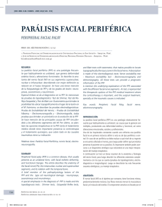 parálisis facial periférica