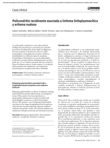 Policondritis recidivante asociada a linfoma linfoplasmocítico y