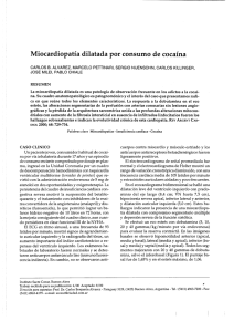 Miocardiopatía dilatada por consumo de cocaína