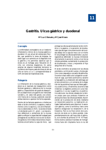 Gastritis. Ulcus gástrico y duodenal