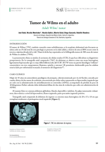 Tumor de Wilms en el adulto - Revista Argentina de Urología
